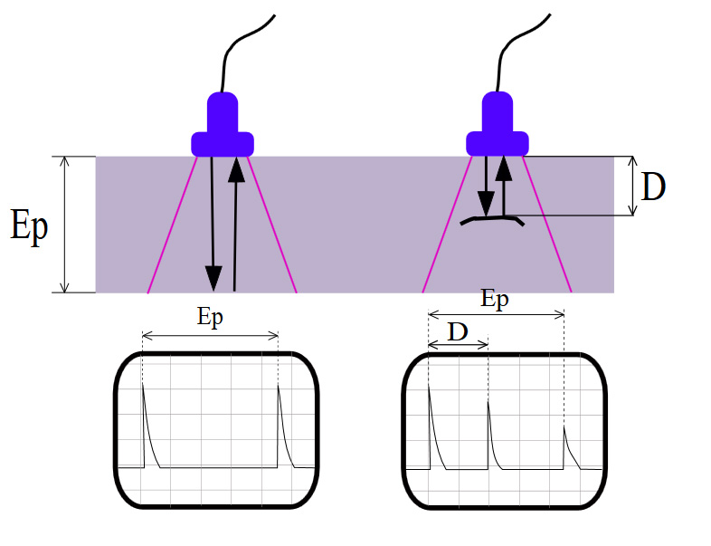 recorder-ultrasound3